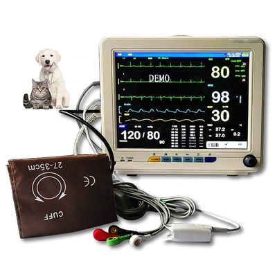 12 Inch Rechargeable Battery Arrhythmia Analysis St Hospital Clinic Home Rescue Segment Analysis Holter Multiparameter Veterinary Patient Monitor